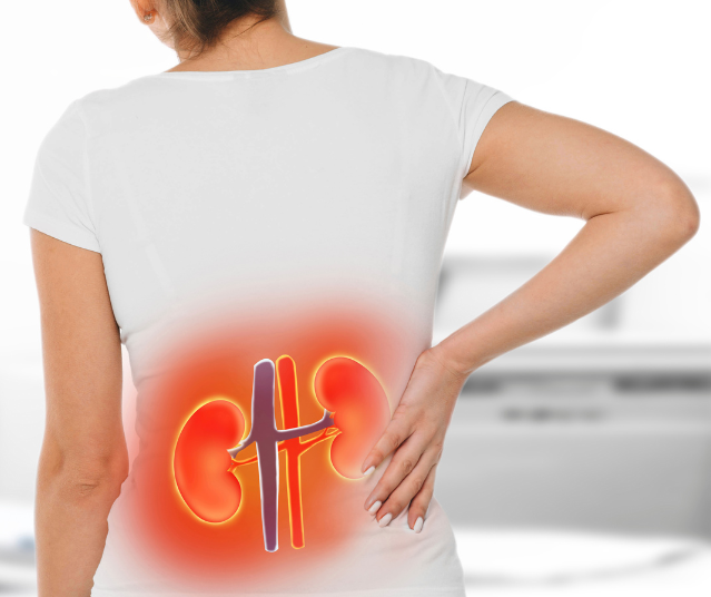 What is the Creatinine Level for Stage 3 Kidney Disease